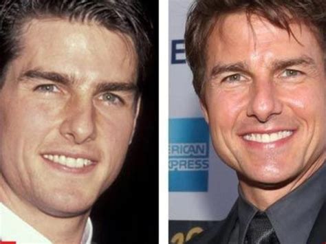 tom cruise teeth before|More.